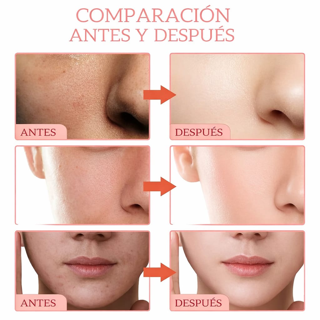 Serum Aclarador 5 en 1 SRRTK