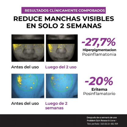 Serum Niacinamide 20% Dark Spot JUMISO