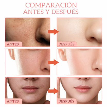 Serum Aclarador 5 en 1 SRRTK